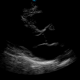 Echocardiography Practice Scans